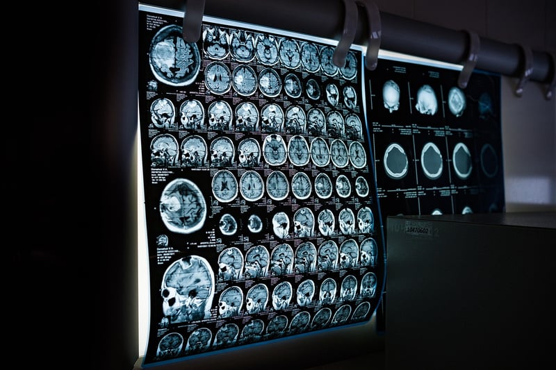 Body Scan Practices